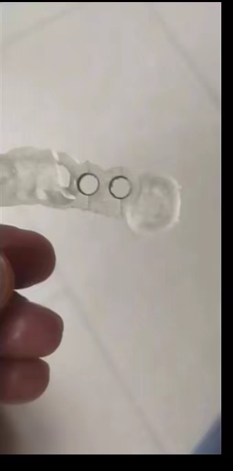 수지 치과용 3D 프린터 심기 가이드 수지 고정밀 인성 - Glue For 3D Printing 리뷰 및 가격